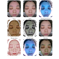 Machine d'analyse intelligente de la peau 3D, alimentée par l'IA, caméra HD 20MP pour visage complet, écran tactile 10,1 pouces, gestion cloud Wi-Fi