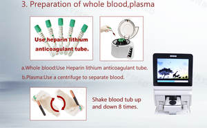 SY-B175V Dry Bioquímica <span class=keywords><strong>Analyzer</strong></span> Portátil Seco Clinical POCT Química Analisador química do sangue rotor mnchip - Product Image 6