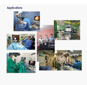 YKD-9001 Led Geïntegreerde Fhd Medische Video Endoscopie Apparatuur Ikeda Laparoscopische Camera Laryngoscoop Endoscopie Metaal Ce - Product Image 6