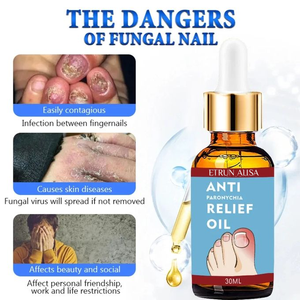 ETRUN ALISA Marque privée <span class=keywords><strong>Huile</strong></span> anti-paronychie endommagée et décoloration <span class=keywords><strong>Huile</strong></span> de soulagement des champignons pour les ongles d'orteils - Product Image 3