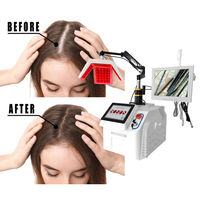 Máquina de Cuidado Capilar con Oxígeno de Alta Frecuencia, Microcorriente para el Crecimiento del Cabello, Tratamiento para la Pérdida de Cabello, Dispositivo para el Recrecimiento Capilar