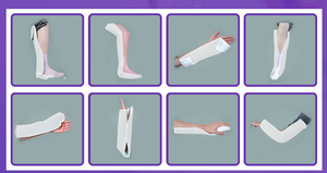 <span class=keywords><strong>Attelle</strong></span> orthopédique en fibre de verre pour l'immobilisation des fractures - Product Image 5