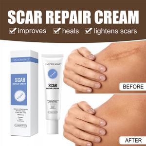 Crema Avanzada para Cicatrices, la Mejor Crema para Cicatrices Antiguas, Queloides y TKA, para Venta al por Menor - Product Image 3