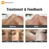 Máquina de Hidrofacial Coreana, Hidrodermoabrasión, Terapia de Hidrógeno y Oxígeno, Hidrafacial Profesional de Agua 7 en 1