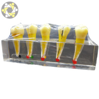 Modèle dentaire de mandibule en PVC pour formation médicale, taille réelle, évolution pathologique des dents, caries, périostite, sciences médicales