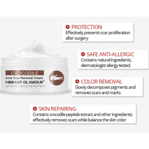 ชุดกำจัดรอยแผลเป็นจากสิว,ชุดครีมสำหรับลบรอย<span class=keywords><strong>สิว</strong></span>แผลเป็นจาก<span class=keywords><strong>สิว</strong></span> - Product Image 3