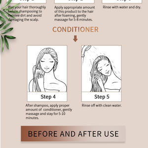 Productos para el cuidado del cabello orgánico, planta <span class=keywords><strong>Natural</strong></span>, champú anticaspa - Product Image 6