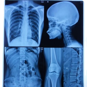 <span class=keywords><strong>AGFA</strong></span> DRYSTAR Película seca médica Materiales de impresión de alta calidad - Product Image 3