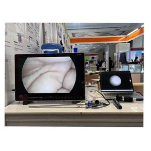 SY-PS050 phẫu thuật bệnh viện Y Tế HD Video nội soi Hệ thống camera cho hysteroscope nội soi phụ khoa - Product Image 1