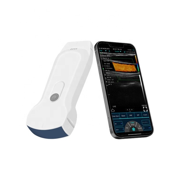 Wireless Ultrasound Machine Price Color Doppler Handheld Wireless Ultrasound Probe