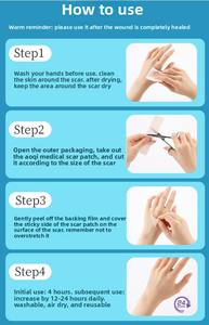 Patch de réparation des cicatrices médicales, gel de silicone pour césarienne, post-chirurgie thyroïdienne, cicatrices légères, chirurgie de double paupière, hyperplasie, plaie - Product Image 3