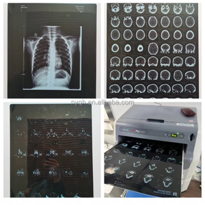 Consumibles Médicos, Película Térmica para Rayos X, Película de Rayos X de Imagen Seca <span class=keywords><strong>Fuji</strong></span> Dry Imaging 10*12, Impresora Drypix <span class=keywords><strong>Lite</strong></span> 2000 - Product Image 1