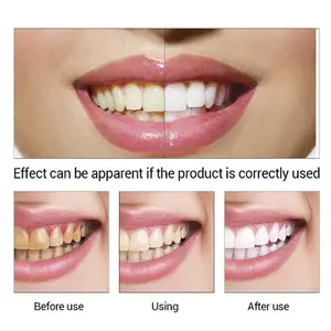 Vendita calda siero sbiancante per denti igiene orale dentale rimuovi macchie Gel per placca essenza per la pulizia dei denti cura dentale - Product Image 6