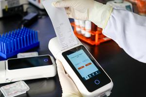 Analizador de Electrolitos y Gases en Sangre Completa Portátil Veterinario, Analizador Multiparamétrico para el Hogar y el Hospital - Product Image 3