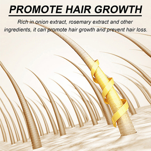 Marque privée Anit naturel-La perte de cheveux renforce la croissance Soins capillaires Repousse des oignons rouges Ensemble de shampoing et d'après-shampoing à la biotine - Product Image 2