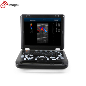 Peralatan sonografi medis sistem Ultrasound kompak dengan probe Array Linear, cembung, dan sewa - Product Image 4