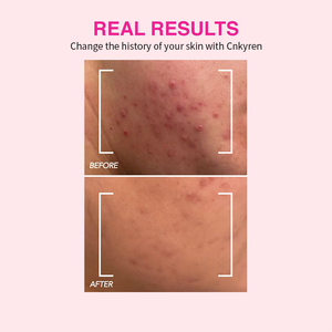 Großhandel Schlamm maske aus dem Toten Meer mit Calendula-Extrakt Mandel öl Tiefen reinigung Reinigung Poren behandlung für das Gesicht - Product Image 5