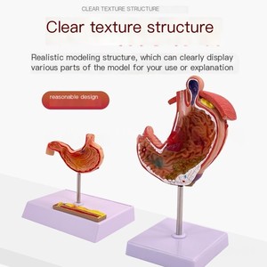 Modelo <span class=keywords><strong>de</strong></span> anatomía educativa <span class=keywords><strong>de</strong></span> Gastroenterología, sección coronal ampliada <span class=keywords><strong>de</strong></span> PVC, perforación patológica del estómago para la ciencia médica - Product Image 3