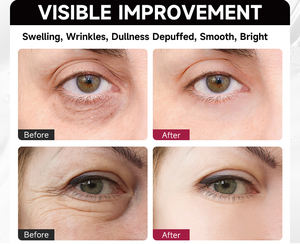 Parches de Hidrogel para <span class=keywords><strong>Ojos</strong></span> con Colágeno para Piel Sensible, Parches de Gel para Extensiones de Pestañas, Calmantes y Fríos, Venta al Por Mayor OEM - Product Image 2