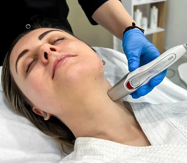 TO US Funkfrequenz fraktionierte Hautrejuvenation Mikronutzung RF Maschine Gesichtspflege-Gerät