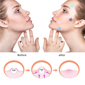 แผ่นแปะสิวแบบใส ไฮโดรคอลลอยด์ แผ่นแปะสิวหน้า ไฮโดรคอลลอยด์ - Product Image 3