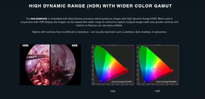 Cable de Fibra Óptica para Endoscopio Médico, Fuente de Luz para Uso ORL, Manual, Silicona, 1.8m-3m, Certificado CE - Product Image 5