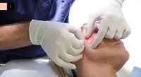 Serat Fiber Sekali Pakai 25cm Khusus untuk Wajah Endolift Laser, Satu Serat untuk Satu Pasien