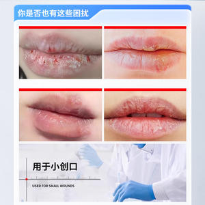 Pansement médical OEM en polyéthylène glycol pour les lèvres, taille personnalisable, protection des plaies - Product Image 2