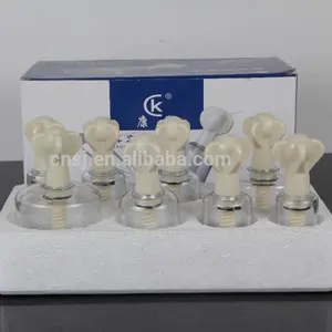 Equipo Médico Profesional chino Hansol, juego de ventosas, fabricación profesional OEM/ODM - Product Image 2