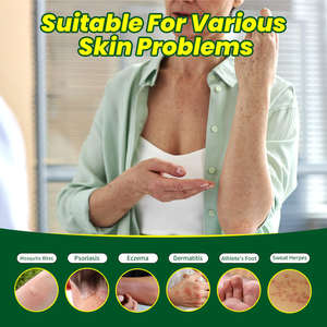 Hautjucken, unerträglich, Psoriasis, Hautallergie, Hautpflege, Hauterhaltung - Product Image 2