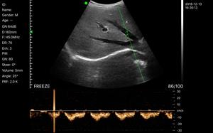 مسبار لاسلكي <span class=keywords><strong>4d</strong></span> 3d Mhz <span class=keywords><strong>Convex</strong></span> سعر ماسح KONTED MDR - Product Image 6