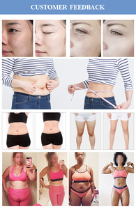 Appareil professionnel multifonctionnel de massage corporel amincissant et sculptant Vela Shape - Product Image 2