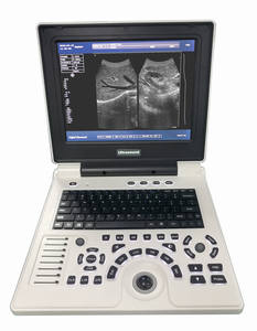 Escáner de Ultrasonido Médico Veterinario Portátil para Aplicaciones Clínicas con Laptop, Máquina de Ultrasonido - Product Image 4