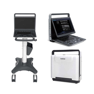 Ecógrafo Doppler Color Portátil Sonoscape E1V 3D 4D para Veterinaria, Perros, Gatos, Equinos, Bovinos, Pantalla LCD <span class=keywords><strong>de</strong></span> 15.6 Pulgadas, 6.5 kg, Veterinario, CE, Clínico - Product Image 1