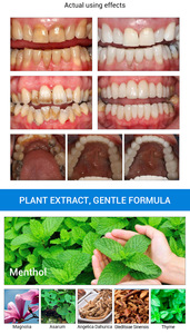 Essence blanchissante pour les dents LANBENAT, sérum de nettoyage pour l'hygiène bucco-dentaire, gel blanc pour les soins dentaires, blanchiment des dents, outils dentaires, sourire parfait, 10 ml - Product Image 3