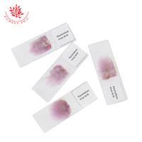 Plasmodium Vivax Microscope Slides Medical Science Parasitology Prepared Slides Microscope Prepared Slides