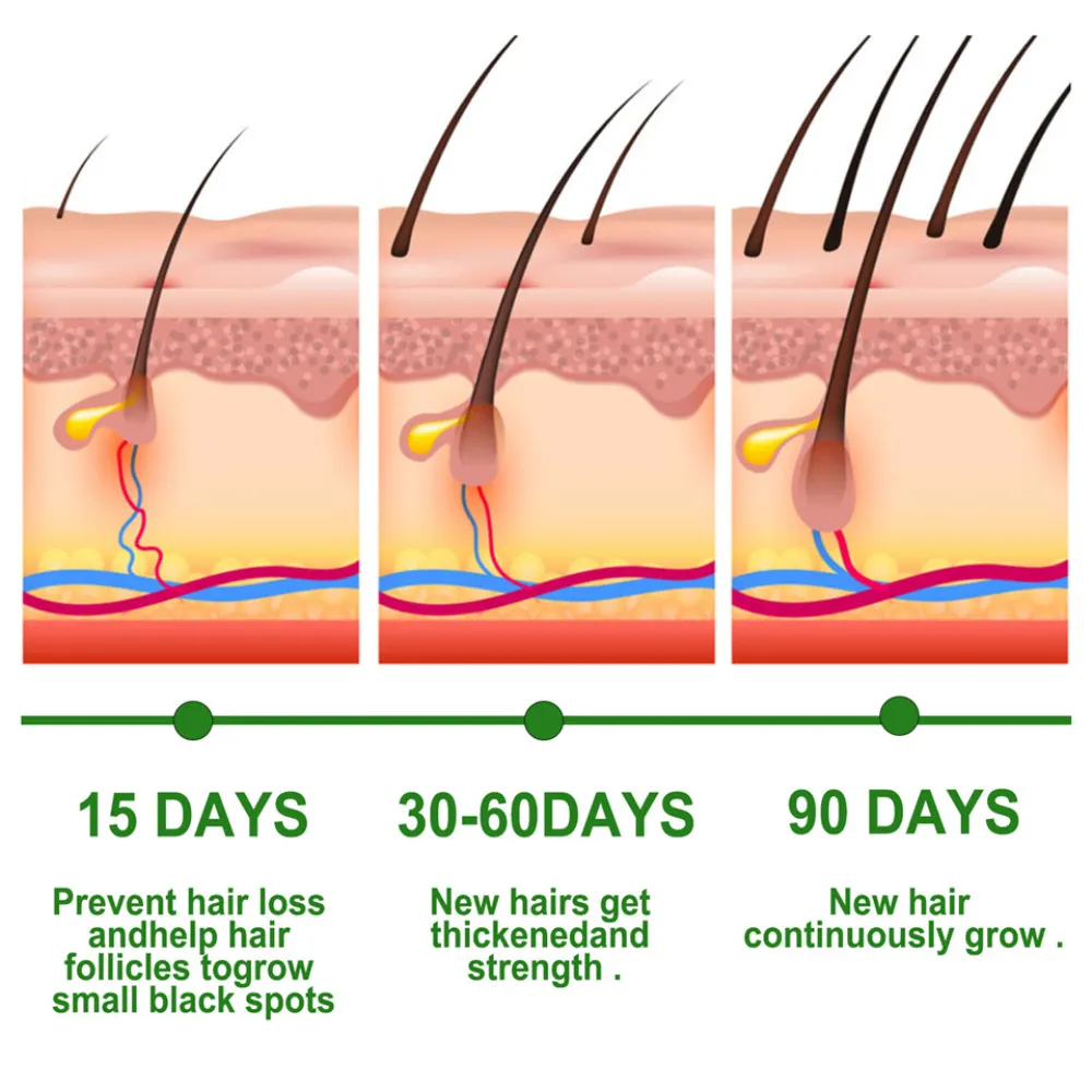 Настраиваемые натуральные органические розмарина мяты для кожи головы для укрепления волос питательное Кондиционирующее масло для волос