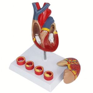 Modelo de corazón KyrenMed corazón con modelo de trombo - Product Image 3