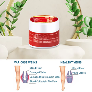 Crema per il Sollievo dalle Varici alle Gambe, Lozione per la Cura del Corpo, Unguento per Gambe Sane, Crampi alle Gambe e Congestione Venosa, Sollievo Esterno - Product Image 4