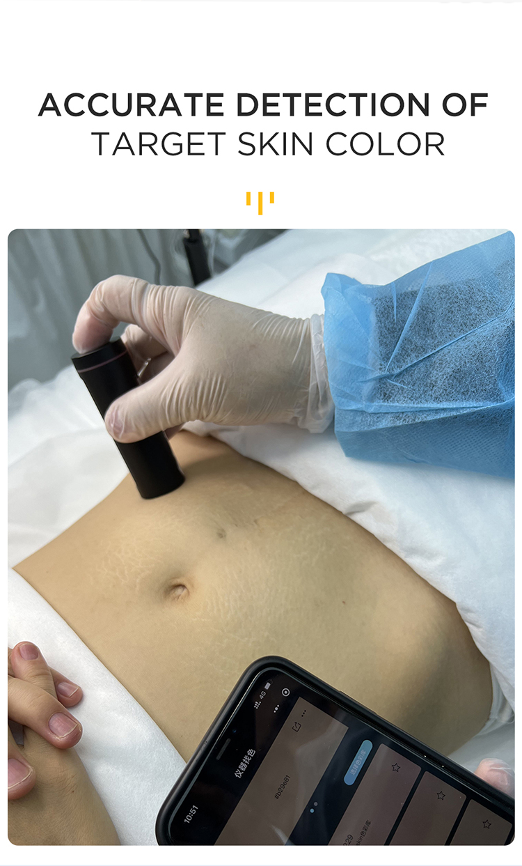 NUOJO Semi Permanent Skin Pigmentenpmu Smart Skin Recognizer