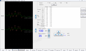 Système EMG KT-H014 2/4/8 canaux, appareil EMG, électromyographie pour diagnostic clinique et diagnostic différentiel - Product Image 6