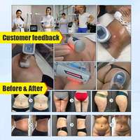 Appareil professionnel vertical Aispirit Endosphere RF pour le raffermissement cutané, anti-rides, lifting du visage et remodelage corporel, avec analyse de la peau