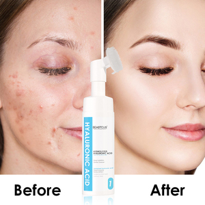 <span class=keywords><strong>Gel</strong></span> <span class=keywords><strong>Limpiador</strong></span> <span class=keywords><strong>Facial</strong></span> con Ácido Hialurónico, Blanqueador, Espumoso, Hidratante, para el Acné, Mousse de Limpieza Profunda, Exfoliante, con Cepillo <span class=keywords><strong>Limpiador</strong></span> <span class=keywords><strong>Facial</strong></span> - Product Image 4