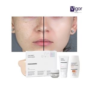 Kit Cosmelan Peel para Uso Doméstico, Producto Español Famoso para Blanquear la Piel, Eliminar Granos, Pecas y Manchas Oscuras - Producto de Cuidado Personal, Set Cosmelan 2 - Product Image 5
