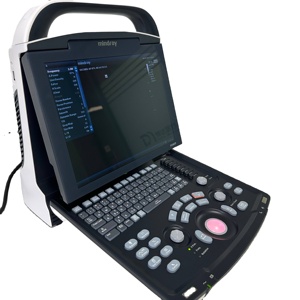 <span class=keywords><strong>Precio</strong></span> Promocional: Ecógrafo Mindray DP-10, Escáner de Ultrasonido Digital Completo DP10 con LED para Aplicaciones Clínicas - Product Image 2