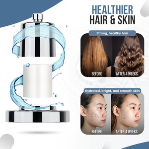 Di lusso in testa di filtraggio <span class=keywords><strong>soffione</strong></span> <span class=keywords><strong>doccia</strong></span>, filtrata testa di <span class=keywords><strong>doccia</strong></span> per acqua dura cloro ad alta pressione pioggia bagno <span class=keywords><strong>doccia</strong></span> - Product Image 2