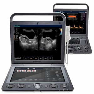 Appareil d'échographie vétérinaire portable Sonoscape S9Vet avec écran tactile haute résolution de 13,3 pouces, garantie de 2 ans - Product Image 6