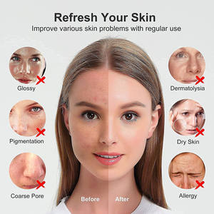 Nuovo piroscafo elettrico nano facciale per la cura personale personalizzato - Product Image 6