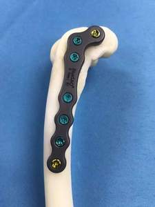 Plaque osseuse en titane vétérinaire <span class=keywords><strong>DFO</strong></span> de 8 mm en forme de L, bleue, implants orthopédiques SAO - Product Image 3