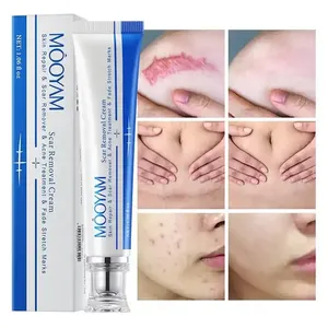 Crème anti-cicatrices la plus rapide OEM en promotion, crème tenseur anti-vergetures et cicatrices 30g MOOYAM - Product Image 2